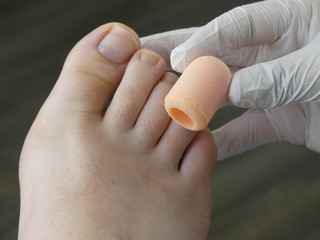 Chiropody Podiatry Medical Foot Care