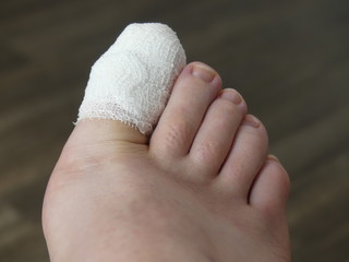 Podiatry Chiropody Foot Medical Stubbed Toe Ingrown Toenail