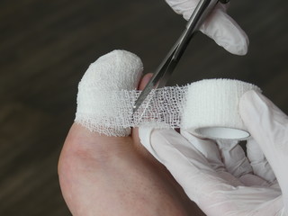 Podiatry Chiropody Foot Medical Stubbed Toe Ingrown Toenail