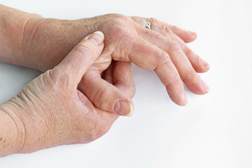 Eine Frau hat Schmerzen in Händen und Fingern leidet unter trockener Haut