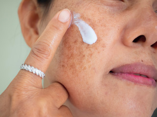 Asian woman are applying cream for facial treatment problem spot melasma pigmentation skincare on...