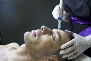 Bb Glow microneedling facial MAN