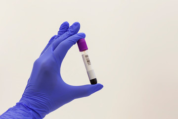 A hand in a blunted latox glove holds a blood test tube on a white background with place for text....