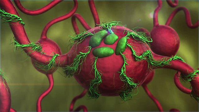 tumor on the human gland, fungal infection and human gland, development of a cancerous tumor on the human gland, inside the human body, medical 3D graphics