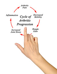 Steps in Cycle of Arthritis Progression.