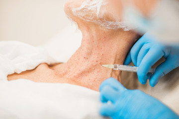 Hands of a cosmetologist during surgery biorevitalization of a woman’s neck skin - close-up