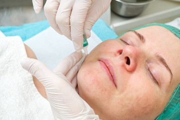 Naklejka premium Beautician applies acid on the face of a girl to burn acne. young woman with problem skin. The concept of cosmetology. The cosmetologist performs a procedure to cleanse the face with problem skin.