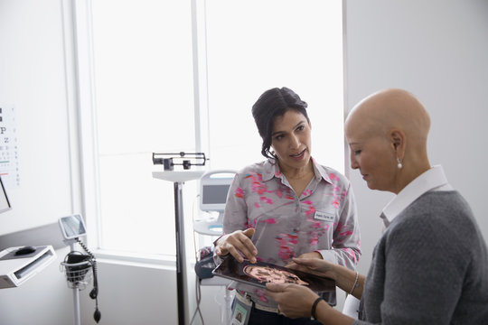 Female Doctor Showing Digital Brain Scan On Digital Tablet To Bald Cancer Patient In Clinic Examination Room