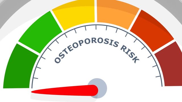 Color scale with arrow from green to red. Osteoporosis risk measuring device. Sign tachometer, speedometer, indicators. Colorful infographic gauge element. 3D rendering