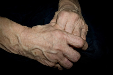 The tired hands of an old woman, with wrinkles, veins, pigmented spots, inflamed joints.