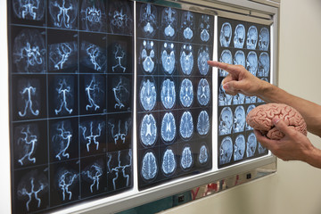 Doctor demonstrating human brain anatomy