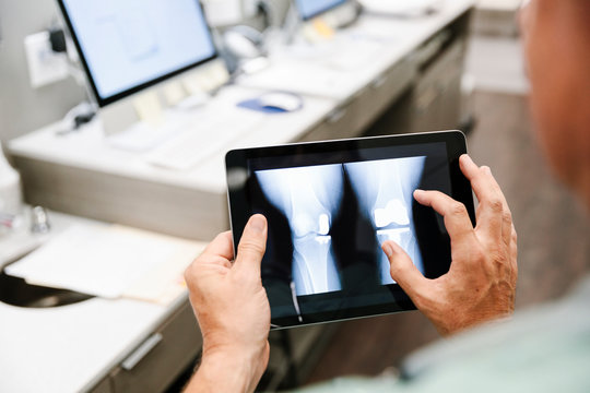 Male Doctor Looking At Knee X-ray On Digital Tablet In Clinic