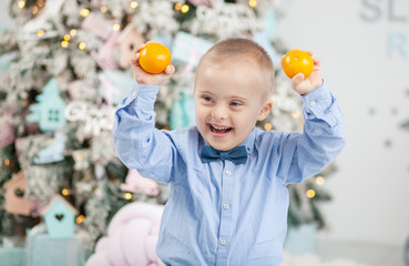 A boy with Down Syndrome holds tangerines in his hands. Genetic and mental illness in a disabled...