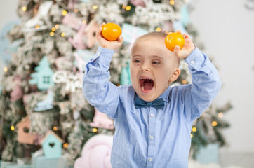 Portrait of a child with Down syndrome. Mental genetic disease, disabled child.