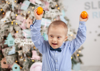 Portrait of a child with Down syndrome. Mental genetic disease, disabled child.