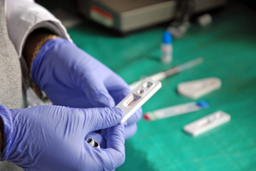 Laboratory analysis of the AIDS virus in Pomerini Village in Tanzania - Africa