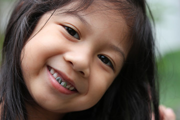 Asian little cute girl smiling with dental crown closed up the camera and her face dry skin in winter season