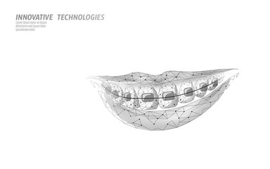 Obraz premium 3D orthodontic braces. Wonam smile tooth trainer. Dental theatment heath care medical banner. Low poly design dentist correction fix vector illustration