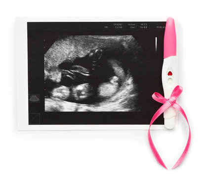Pregnancy test and sonogram image on white background
