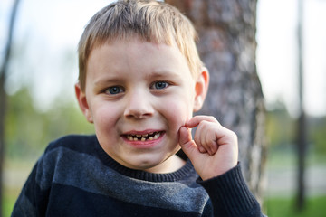 Little boy with fallen teeth.