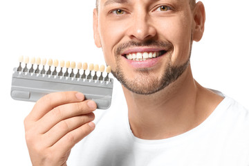 Man with teeth color samples on white background