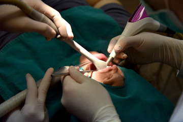 Dental care check up, Dentist examining and doing teeth treatment in dental clinic, Yearly visit...