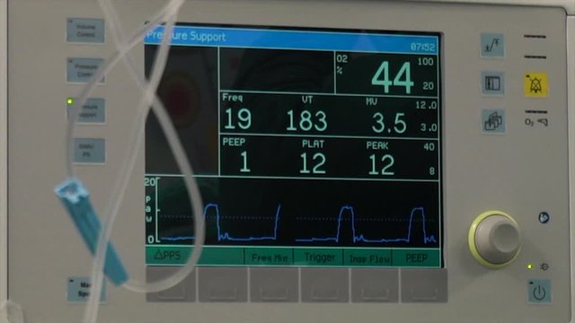 The patient status screen in the operating room