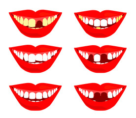 Smile with teeth on a white background. Dentistry Problems and dental prosthetics. Vector illustration.