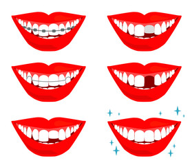 Smile with teeth on a white background. Dentistry Vector illustration. 