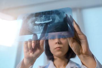 Close up picture of young woman doctor dentist who analysis dental x ray orthopantomogram. Dental...
