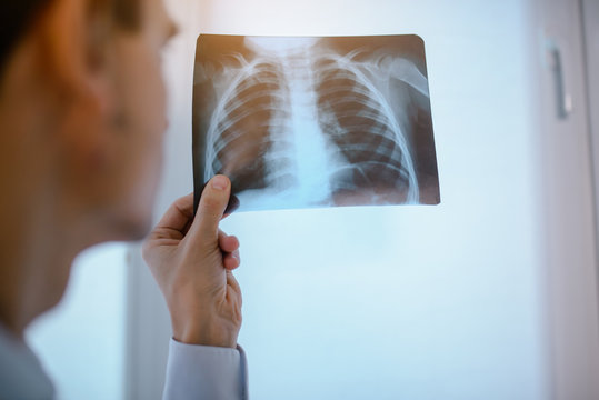 Close up picture of young man doctor who analysis chest x ray