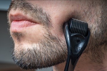 Facial hair care concept. Young man is using derma roller on beard. - obrazy, fototapety, plakaty