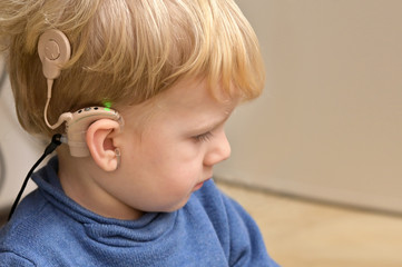 Boy With A Hearing Aids And Cochlear Implants - 316799412