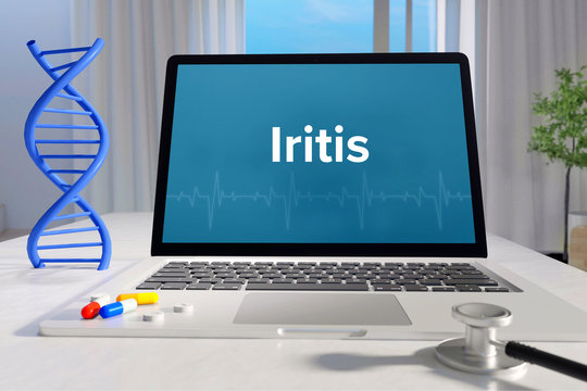 Iritis &ndash; Medizin/Gesundheit. Computer im B&uuml;ro mit Begriff auf dem Bildschirm. Arzt/Gesundheitswesen