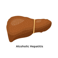 Alcoholic hepatitis liver icon isolated on white background. Liver disease concept illustration in flat design.