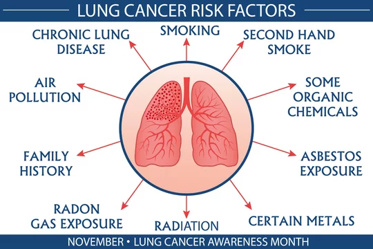 Lung Cancer Risk Factor Infographic Vector Illustration Health And Healthcare Concept Design For Presentation Banner Brochure Etc Eps 10 Vector Printable Cmyk Colors Stock Vector Adobe Stock