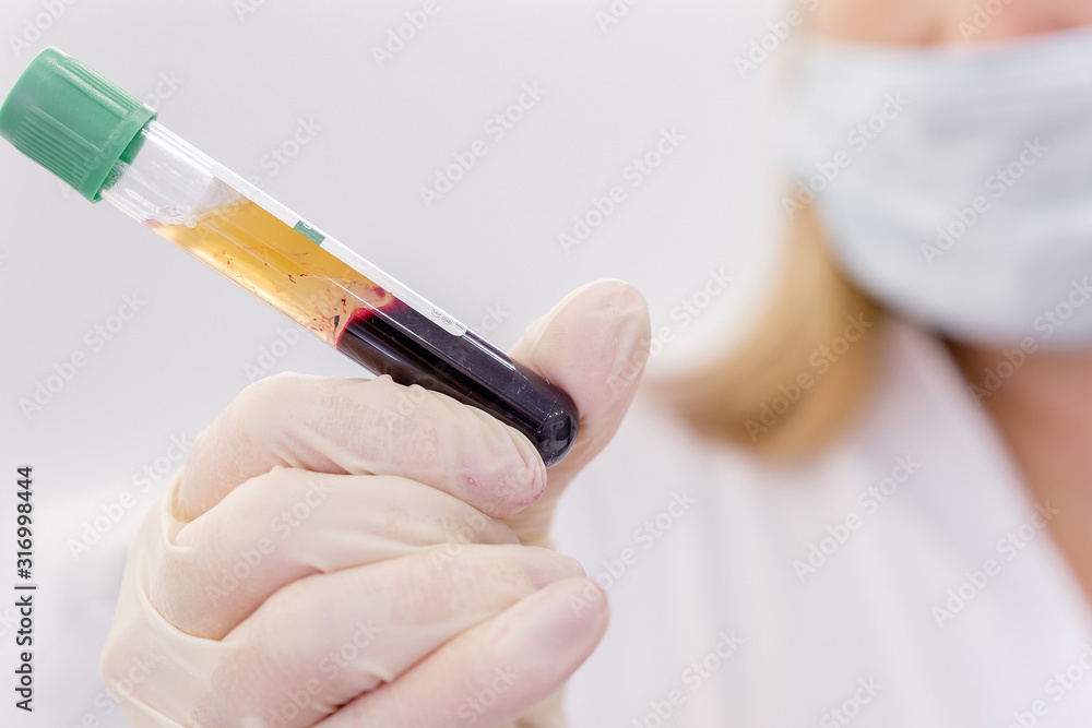 Wall mural young attractive doctor with mask on face in scrub and gloves holds in hand test tube with separated