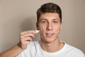 Teen guy with acne problem applying cream on beige background