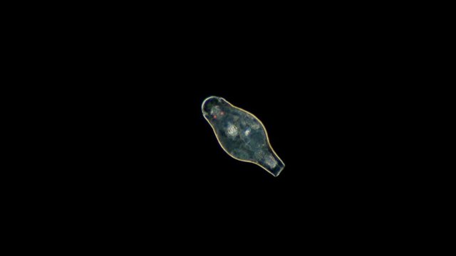 microscopic freshwater Rotifera, type Protostomia, most species are free-living, but parasites and commensals are also found