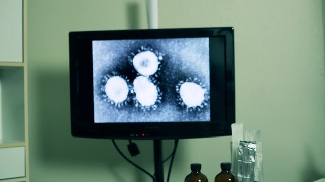 Handheld scene moves past test tubes and other laboratory equipment to a displayed image of the Wuhan Coronavirus virus on a computer monitor.