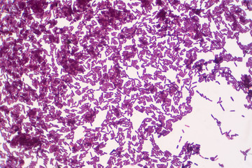 Bacillus gram positive stain under microscope view. Bacillus is rod-shaped bacteria.