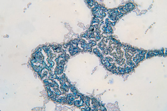 Saccharomyces cerevisiae yeast budding cell under microscope.
