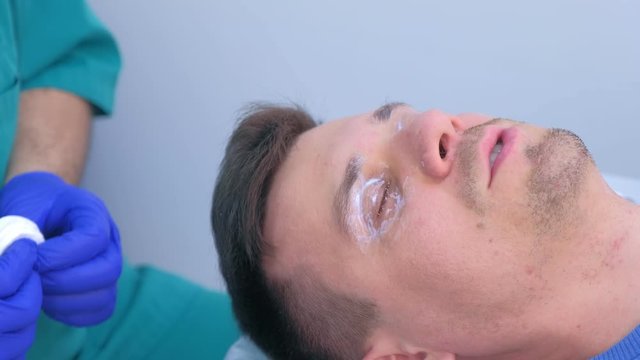 Man patient with anesthetic cream on eyes skin, face closeup, side view. Local anesthesia around eyes before eyelids papillomas laser removing in clinic. Growths on eyelids skin, preparing to removal.