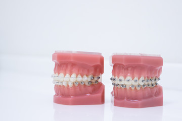 Close up tooth model / mock tooth in dental clinic. Mock tooth or tooth model is used by dentist to demonstrate how human teeth & jaw works. Dental care and dentist 's equipment concept. Copy space.
