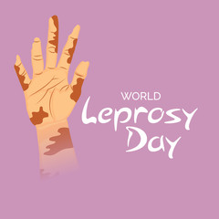 World leprosy day.