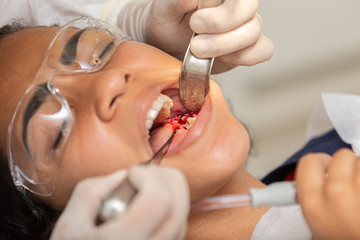 Young woman being seen in a dentist's office. Concept of toothache, wisdom tooth extraction,...