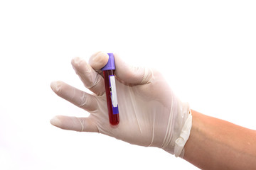 Male hand in protective gloves holding test tube with blood sampler isolated on white