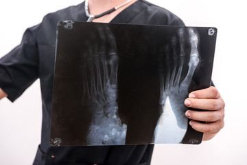 Handsome and young doctor holding foot x-ray of a patient . Medical help concept