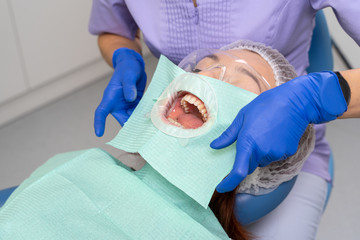 For the comfort of the patient, the dentist sets a napkin under the rubber dam installed in the oral cavity.