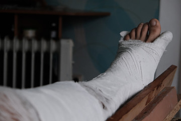 Fototapeta na wymiar Young man with broken plaster leg